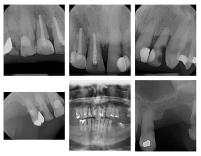 Montages em94hh - Eugenol