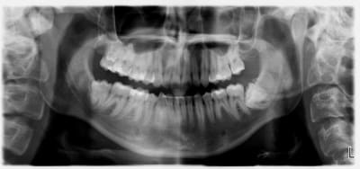 Mutante38 39 vq104a - Eugenol