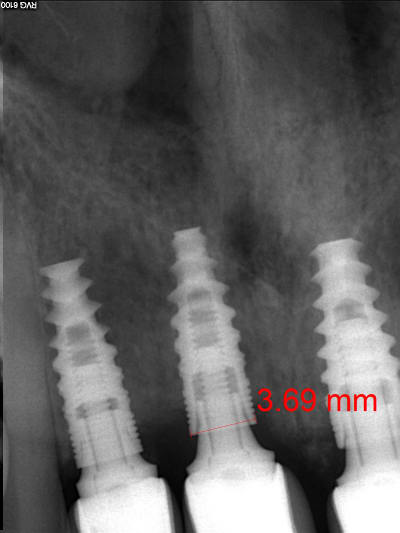 Mw6rb7cr08tech3gwfug - Eugenol