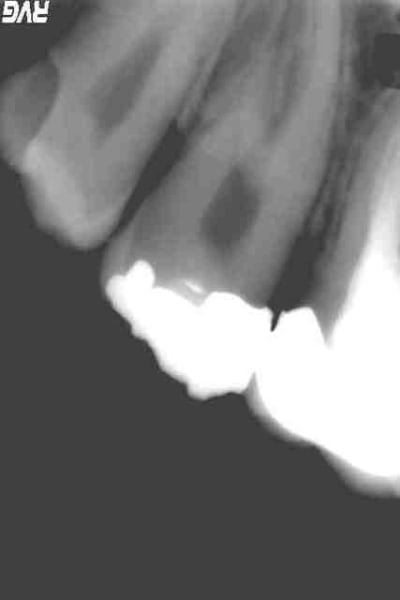 N crose bghgbo - Eugenol