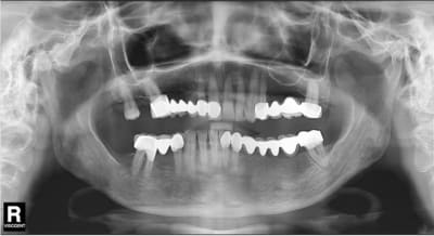 Necroses333333 mcm4ut - Eugenol