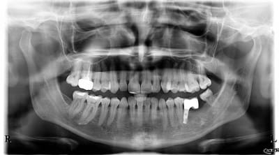 Niqhtcu1iieyrvived8y - Eugenol