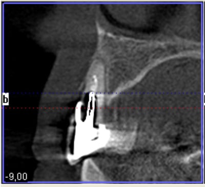 Niveau 12 slt3od - Eugenol