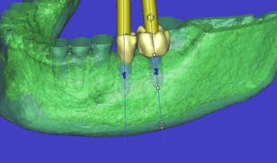 Od 3d pxc6tu - Eugenol