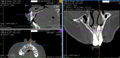 Odontoide1 a2jxjo - Eugenol