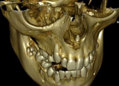 Odontoide2 gp1uak - Eugenol