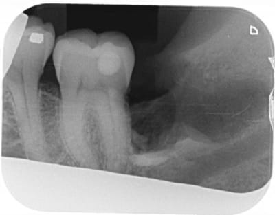 Op ex1 ztei32 - Eugenol