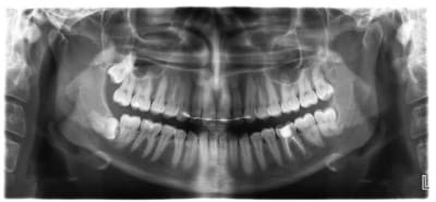 Op ex 38 48 hvoxkn - Eugenol