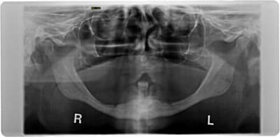 Opg 2015 09 02 jh7j2q - Eugenol