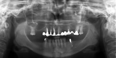 Opt cal pqcqyz - Eugenol