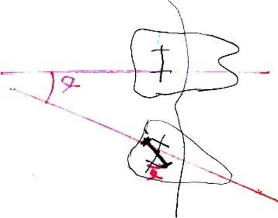 Ortho panicard hnjlcq - Eugenol