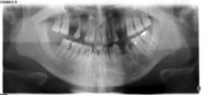 Ost i2rp2v - Eugenol
