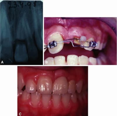 Ovidweb t3nbq3 - Eugenol