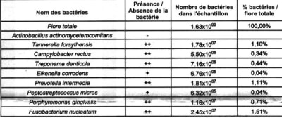 Péri implantite2 d0ilp1 - Eugenol