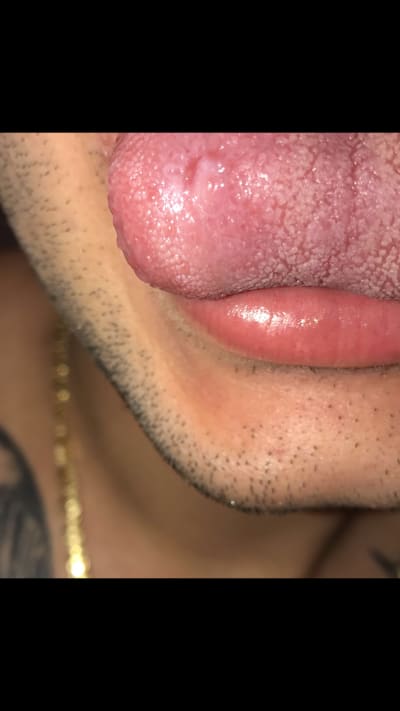 P146h8uiv1j0h6myjlnq - Eugenol