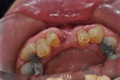 P 371 yo5zct - Eugenol