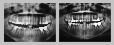 Pano 1 whnhsx - Eugenol