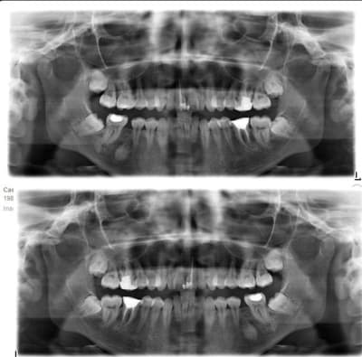 Pano calou ewx8a4 - Eugenol