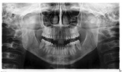 Pano1 2 ptsygl - Eugenol