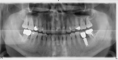 Pano1 zv37fl - Eugenol