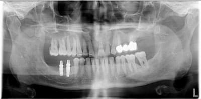 Pano2 olky9m - Eugenol