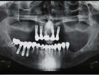 Pano 1 cuca1a - Eugenol