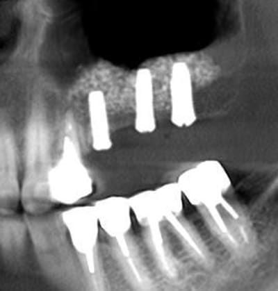 Pano 7 mois cesxkm - Eugenol
