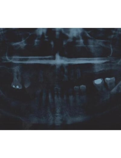 Pano a orxnx8 - Eugenol