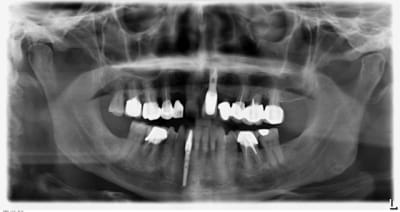 Pano b7ukst - Eugenol