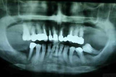 Pano début 2001 fqxcm5 - Eugenol