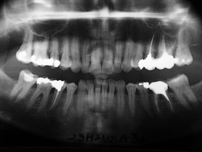 Pano f1g1eh - Eugenol
