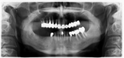 Pano fin sgdoom - Eugenol