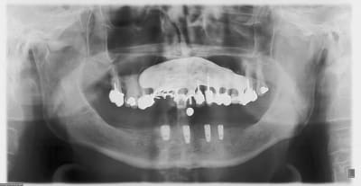 Pano fvkyf0 - Eugenol