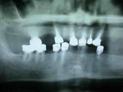 Pano initiale uapafb - Eugenol