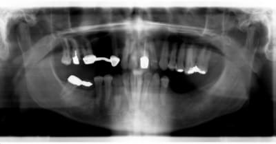 Pano kec ddv65h - Eugenol