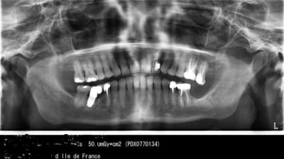 Pano mai 2012 bw6pw4 - Eugenol