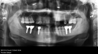 Pano oonk2p - Eugenol