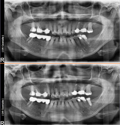 Pano oua uawzie - Eugenol