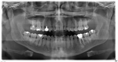Pano q8f5qs - Eugenol
