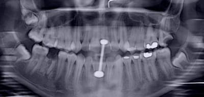Pano rovrsg - Eugenol