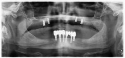 Pano sk76ny - Eugenol