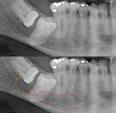 Pano wyl3rv - Eugenol
