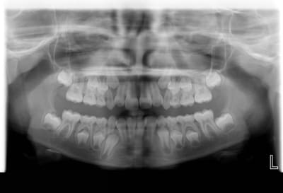 Panoramique02 hsnpa5 - Eugenol