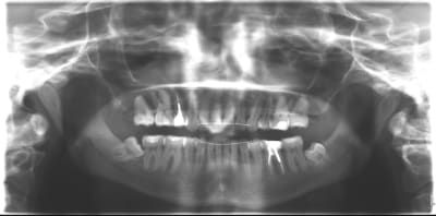 Panoramique m4u8z7 - Eugenol