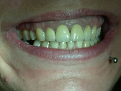 Pas2 fp44nu - Eugenol