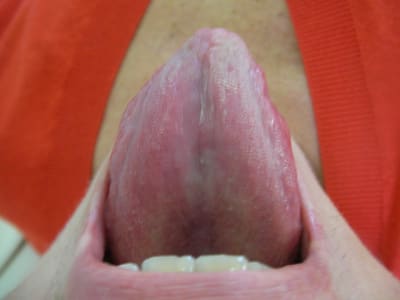 Pat25  2  ghbhbi - Eugenol