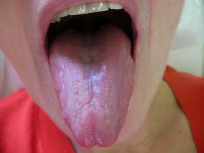 Pat25 zrcblz - Eugenol