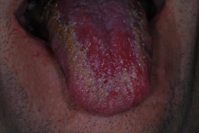 Patho1 pm43te - Eugenol