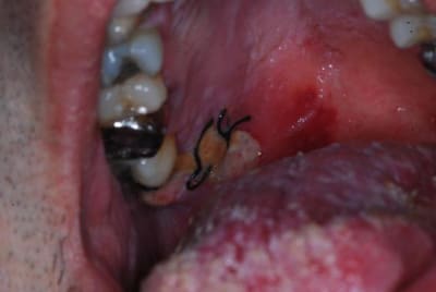 Patho2 fqkuvq - Eugenol