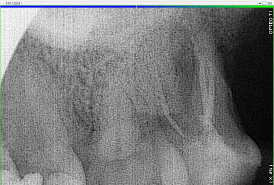 Pbmzgae1620xqhtbzwsm9utbnkpn - Eugenol